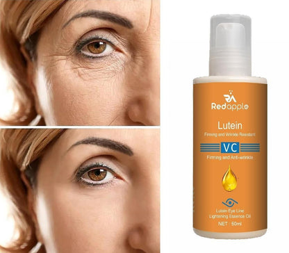 Dinkiss Lutein Eye Essence Oil || 🔥 BUY 1 GET 1 FREE 🔥