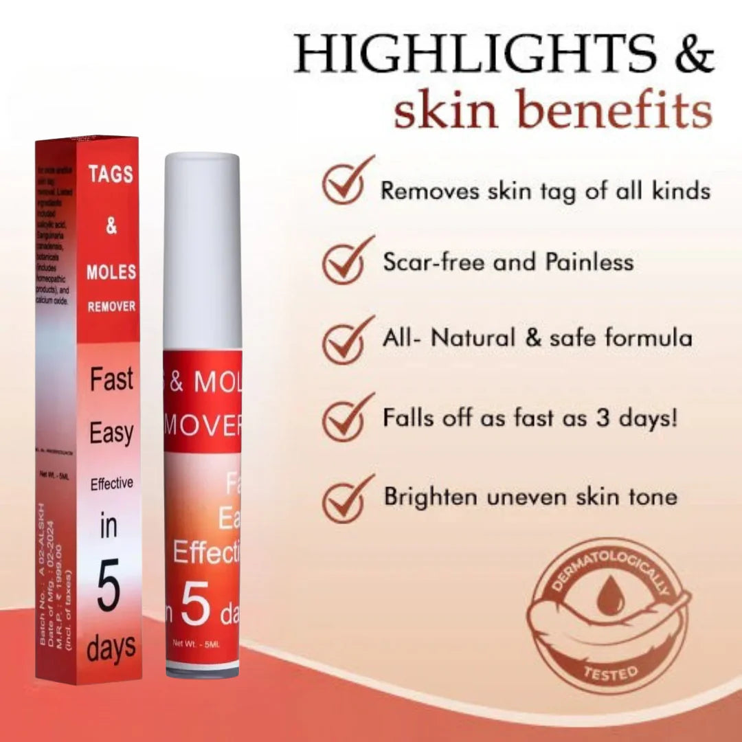 LOVILDS™ Tags & Moles Remover (Buy 1 Get 1 Free🔥🔥)