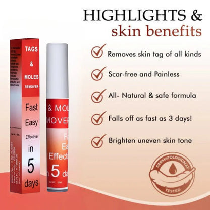 LOVILDS™ Tags & Moles Remover (Buy 1 Get 1 Free🔥🔥)